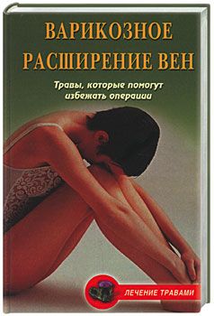 Подколзина Вера - Варикозное расширение вен. Травы, которые помогут избежать операции скачать бесплатно