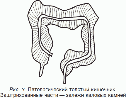 Полное очищение организма по Малахову - Кородецкий Александр - Google Books