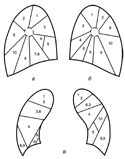 Сегменты легких. Доли и сегменты легкого схема. Сегментарное строение легких схема. Сегменты легких сбоку. Сегменты легких спереди.