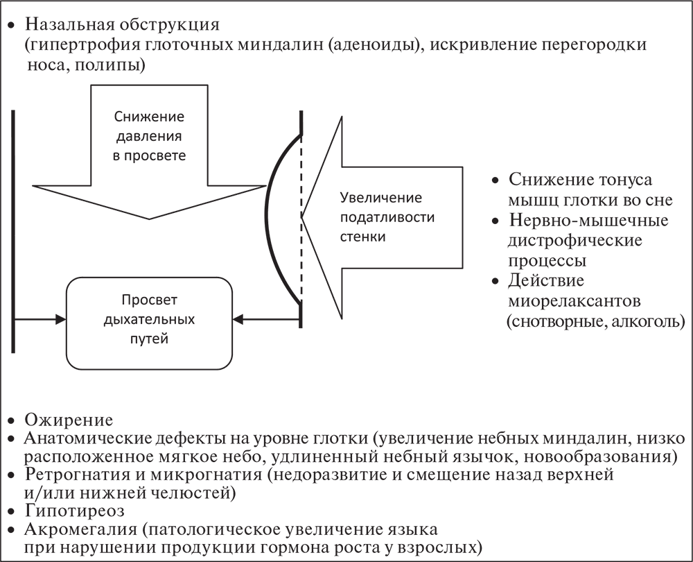 Виды обструкции дыхательных путей схема