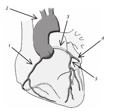 Стенокардия книги. Передняя межжелудочковая ветвь левой венечной артерии. Передняя межжелудочковая борозда. Стенокардия книга. Левая ветвь.