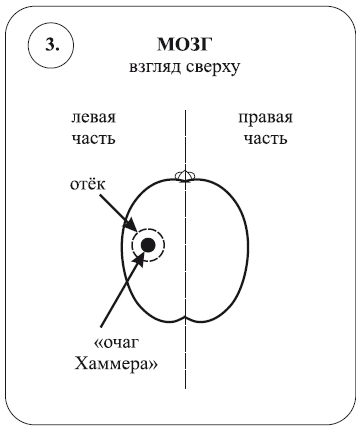 Жильбер рено исцеление воспоминанием обучение