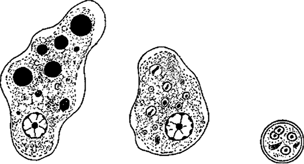 Амеба симптомы. Форма Магна дизентерийной амебы. Амебиаз вегетативная форма. Forma Magna дизентерийной амебы. Entamoeba histolytica вегетативная форма.